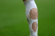 5th May 2024; Stamford Bridge, Chelsea, London, England: Premier League Football, Chelsea versus West Ham United; The holes in the socks of Conor Gallagher of Chelsea in order to reduce pressure on the calf