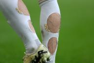5th May 2024; Stamford Bridge, Chelsea, London, England: Premier League Football, Chelsea versus West Ham United; The holes in the socks of Conor Gallagher of Chelsea in order to reduce pressure on the calf