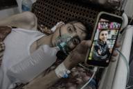 May 16, 2024 - Gaza: A Palestinian young man, Abdul Majeed Al-Sabakhi, 20, is undergoing treatment at Al-Aqsa Martyrs Hospital in Deir Al-Balah, on 16 May 2024. where he suffers from severe lung infections after being exposed to toxic gases from an Israeli missile that targeted his neighborsâ house. Al-Sabakhi weighed 55 kilos before the war, while after inhaling Israeli gas, he became It weighs 20 kilos. (Omar Ashtawy\/APAImages\/Polaris