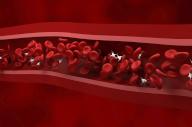 Illustration of a low number of platelets, or thrombocytes, (white) in the blood stream, a condition known as thrombocytopaenia. Platelets play a vital role in blood clotting and therefore thrombocytopenia leads to bruising and bleeding that can be