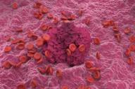 Illustration of red blood cells and fibrin (dark pink). The production of fibrin is triggered by cells called platelets, activated when a blood vessel is damaged. The fibrin binds the various blood cells together, forming a solid structure called a
