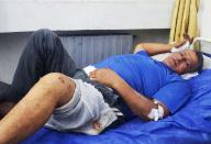 (240530) -- BANIYAS, May 30, 2024 (Xinhua) -- A victim lies in a hospital following an Israeli missile strike in Baniyas city, northern Syria, May 29, 2024. A girl was killed and 10 other civilians were wounded on Wednesday in a new round of Israeli strikes on Syrian sites, the Syrian Defense Ministry said. In a statement, the ministry said the Israeli army launched an aerial attack from the direction of Lebanon at around 7:30 p.m. local time (1630 GMT), targeting a military site in the central province of Homs and a residential building in the coastal city of Baniyas. (Str/Xinhua